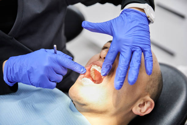 Best Emergency Wisdom Tooth Extraction in Newellton, LA