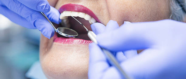 Best Emergency Dental Care for Sports Injuries in Newellton, LA